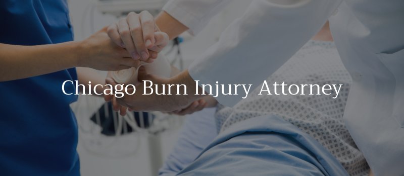 Chicago Burn Injury Attorney